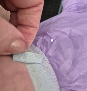 Tape holding rubbish bag over cast