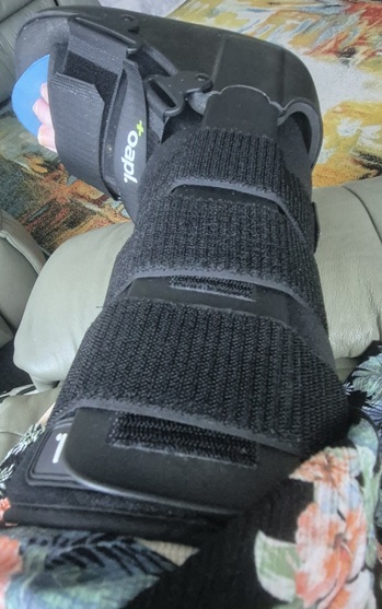 Right leg in a moon boot
